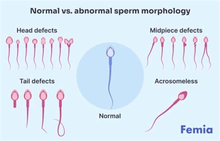 Can you get pregnant with low sperm morphology?