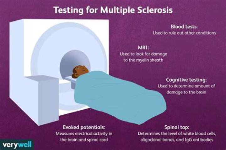 Do you need contrast to diagnose MS?