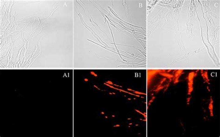 How is Phomopsis treated?