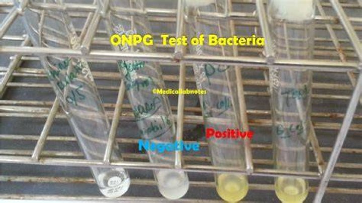 What bacteria are Onpg positive?
