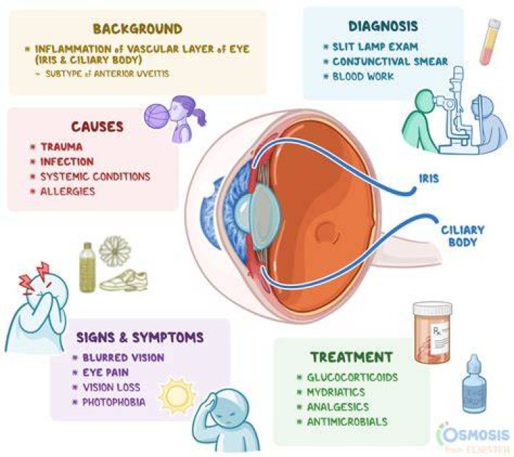 What is plastic Cyclitis?