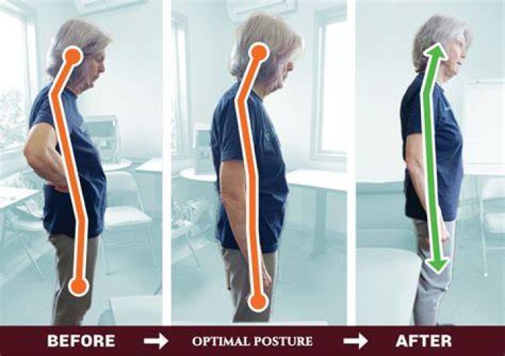 What is the Alexander method for posture?
