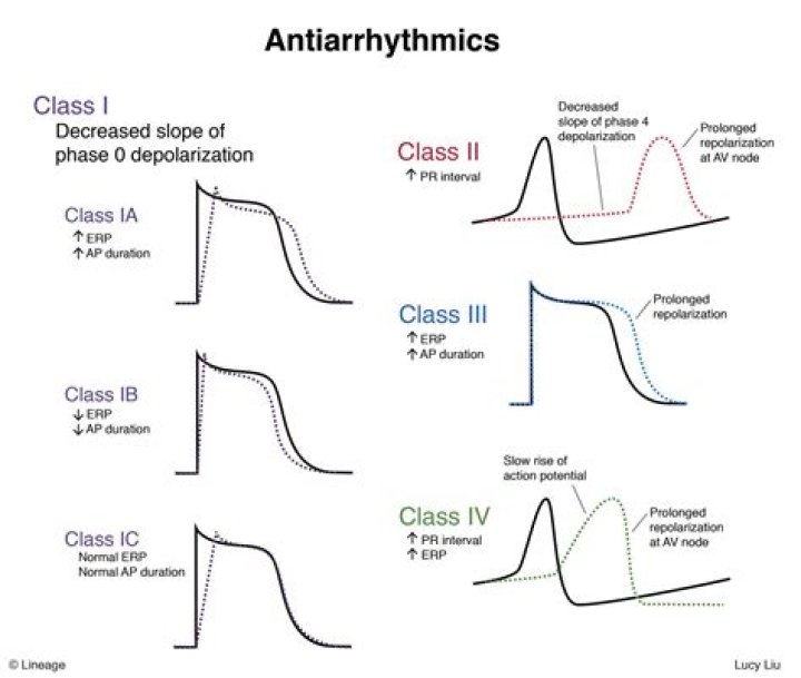 Which class of antiarrhythmics increase action potential?