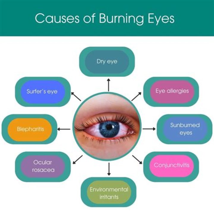 Why do my eyes go red and burn?