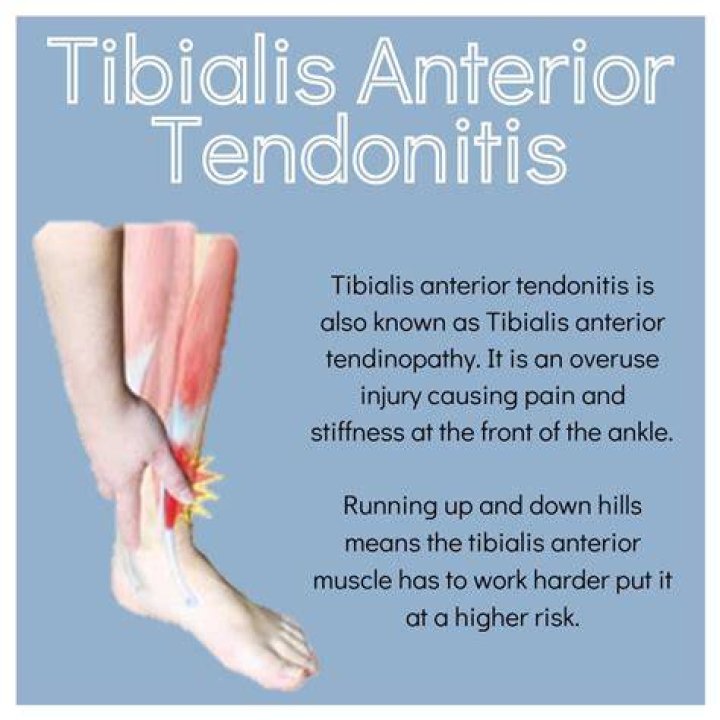Why would my tibialis anterior hurt?
